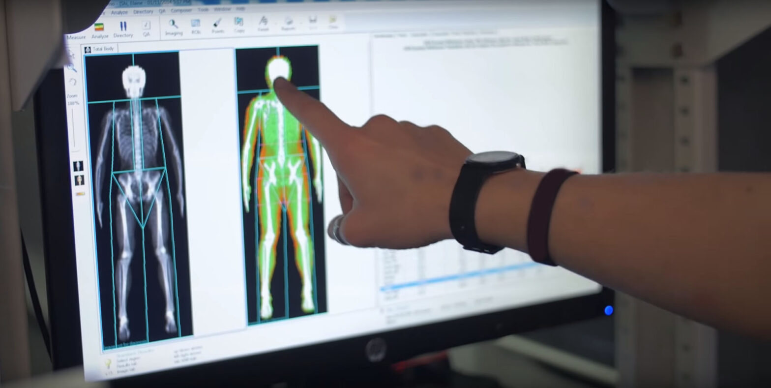 Image of DEXA Scan analysis view of bone and muscle